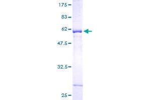 Image no. 1 for N-Acetyltransferase 6 (GCN5-Related) (NAT6) (AA 23-308) protein (GST tag) (ABIN1312021) (NAT6 Protein (AA 23-308) (GST tag))