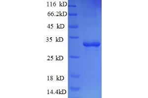 SDS-PAGE (SDS) image for Tryptase alpha/beta 1 (TPSAB1) (AA 11-243), (partial) protein (His tag) (ABIN4977090)
