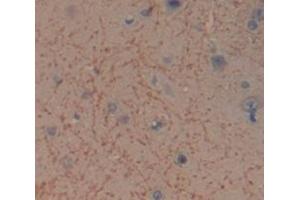 Used in DAB staining on fromalin fixed paraffin- embedded Kidney tissue (ITSN1 Antikörper  (AA 1-227))