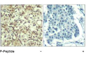 Image no. 1 for anti-V-Akt Murine Thymoma Viral Oncogene Homolog 1 (AKT1) (pThr450) antibody (ABIN319271) (AKT1 Antikörper  (pThr450))