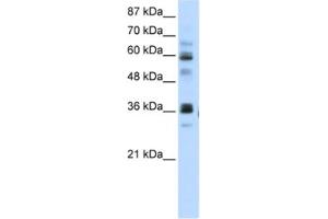 Western Blotting (WB) image for anti-RNA Pseudouridylate Synthase Domain Containing 2 (RPUSD2) antibody (ABIN2462340) (RPUSD2 Antikörper)