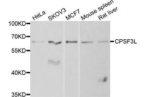 Western blot analysis of extracts of various cell lines, using CPSF3L antibody (ABIN5973943) at 1/1000 dilution. (CPSF3L Antikörper)