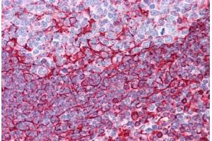 Human Tonsil: Formalin-Fixed, Paraffin-Embedded (FFPE)