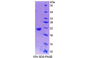 SDS-PAGE analysis of Rat GaA Protein. (GAA Protein)