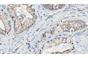 ABIN6277747 at 1/100 staining Human prostate tissue by IHC-P. (IRS2 Antikörper  (C-Term))