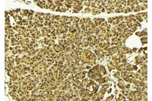 ABIN6269396 at 1/100 staining Mouse pancreas tissue by IHC-P. (HDAC8 Antikörper  (N-Term))