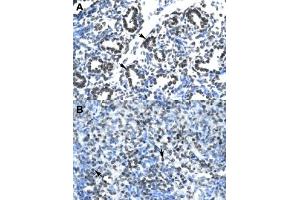 Immunohistochemical staining (Formalin-fixed paraffin-embedded sections) of human lung (A) and human spleen (B) with CLDN17 polyclonal antibody  at 4-8 ug/mL working concentration. (Claudin 17 Antikörper  (Internal Region))