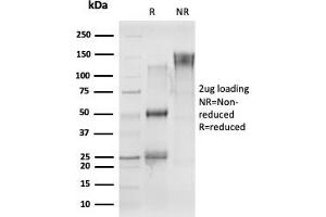 SDS-PAGE Analysis Purified CELF2 Mouse Monoclonal Antibody (PCRP-CELF2-1E4) Confirmation of Purity and Integrity of Antibody. (CELF2 Antikörper)