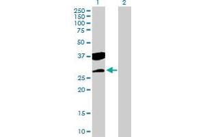 Western Blot analysis of CTDSP2 expression in transfected 293T cell line by CTDSP2 MaxPab polyclonal antibody. (CTDSP2 Antikörper  (AA 1-271))