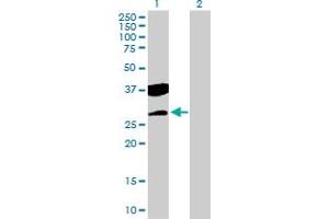 Western Blot analysis of CTDSP2 expression in transfected 293T cell line by CTDSP2 MaxPab polyclonal antibody.