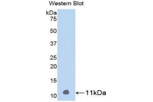Western Blotting (WB) image for anti-Parathyroid Hormone (PTH) (AA 31-115) antibody (ABIN1078421) (PTH Antikörper  (AA 31-115))