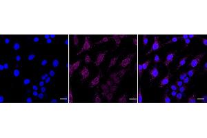 Immunocytochemical staining of HeLa cells with PIK3C3 antibody (ABIN7799819), 1:1,000). (Rekombinanter PIK3C3 Antikörper)