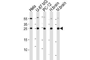 Western blot analysis of lysates from Hela, U-87 MG, rat PC-12 cell line , huamn brain and mouse brain tissue lysate(from left to right), using RAB35 Antibody (C-term) (ABIN6244138 and ABIN6577420). (RAB35 Antikörper  (C-Term))