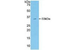 Detection of Recombinant Grb7, Human using Polyclonal Antibody to Growth Factor Receptor Bound Protein 7 (Grb7) (GRB7 Antikörper  (AA 66-327))