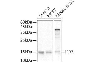 Western blot analysis of extracts of various cell lines, using IER3 antibody (ABIN6134174, ABIN6142158, ABIN6142159 and ABIN6224665) at 1:500 dilution. (IER3 Antikörper  (C-Term))