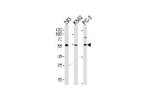 Western blot analysis of lysates from 293,K562,PC-3 cell line (from left to right),using PIP5KL1 Antibody (N-term) (ABIN655244 and ABIN2844847). (PIP5KL1 Antikörper  (N-Term))