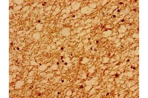 Immunohistochemistry of paraffin-embedded human brain tissue using ABIN7168566 at dilution of 1:100 (Sacsin Antikörper  (AA 983-1150))