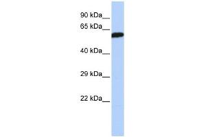 DLD antibody used at 1 ug/ml to detect target protein. (DLD Antikörper  (Middle Region))