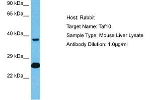 Host: Mouse Target Name: TAF10 Sample Tissue: Mouse Liver Antibody Dilution: 1ug/ml (TAF10 Antikörper  (C-Term))