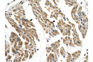 SLC35F2 antibody was used for immunohistochemistry at a concentration of 4-8 ug/ml to stain Skeletal muscle cells (arrows) in Human Muscle.