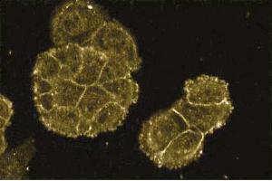 Immunofluorescence staining of A431 cells (Human epithelial carcinoma, ATCC CRL-1555). (FKBP10 Antikörper  (AA 434-576))