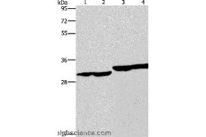 Western blot analysis of Human endometrial carcinoma and colon cancer tissue, human fetal liver tissue and PC3 cell, using DECR1 Polyclonal Antibody at dilution of 1:300 (DECR1 Antikörper)