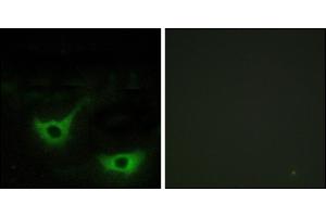 Immunofluorescence analysis of NIH/3T3 cells, using CALR antibody. (Calreticulin Antikörper)