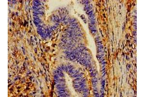 Immunohistochemistry (IHC) image for anti-Cytochrome P450, Family 1, Subfamily A, Polypeptide 1 (CYP1A1) (AA 97-254) antibody (ABIN7149202)