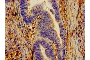 Immunohistochemistry of paraffin-embedded human lung tissue using ABIN7149202 at dilution of 1:100 (CYP1A1 Antikörper  (AA 97-254))