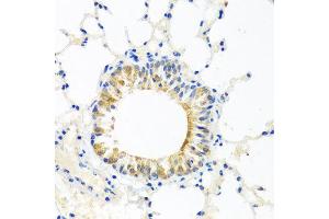 Immunohistochemistry of paraffin-embedded mouse lung using COQ7 antibody at dilution of 1:100 (x40 lens). (Coq7 Antikörper)