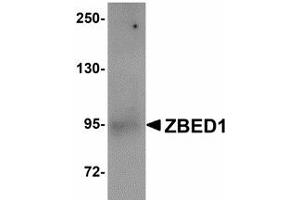 Image no. 1 for anti-Zinc Finger, BED-Type Containing 1 (ZBED1) (Internal Region) antibody (ABIN478064) (ZBED1 Antikörper  (Internal Region))