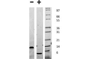 SDS-PAGE of Mouse Epidermal Growth Factor Recombinant Protein SDS-PAGE of Mouse Epidermal Growth Factor Recombinant Protein. (EGF Protein)