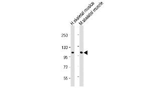All lanes : Anti-CLCN1 Antibody (N-Term) at 1:2000 dilution Lane 1: Human skeletal muslce lysate Lane 2: Mouse skeletal muscle lysate Lysates/proteins at 20 μg per lane. (CLCN1 Antikörper  (AA 32-66))