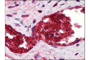 Image no. 1 for anti-Solute Carrier Family 4, Anion Exchanger, Member 1 (erythrocyte Membrane Protein Band 3, Diego Blood Group) (SLC4A1) (N-Term) antibody (ABIN372308)