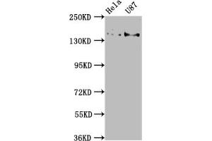 Western Blot Positive WB detected in: Hela whole cell lysate, U87 whole cell lysate All lanes: MYO5A antibody at 1:2000 Secondary Goat polyclonal to rabbit IgG at 1/50000 dilution Predicted band size: 216, 213, 219 kDa Observed band size: 216 kDa (MYO5A Antikörper  (AA 1087-1220))