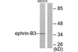 Western blot analysis of extracts from SKOV3 cells, using EFNB3 Antibody.