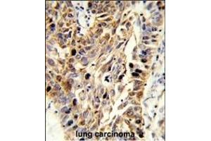 Immunohistochemistry (Paraffin-embedded Sections) (IHC (p)) image for anti-Fibulin 3 (FBLN3) (AA 119-148), (N-Term) antibody (ABIN653039)