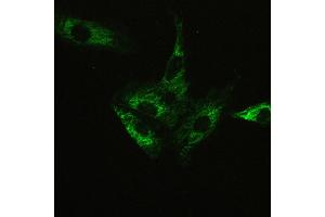 IHC analysis of ATX2 using anti-ATX2 antibody .