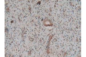 Immunohistochemistry (IHC) image for anti-Coagulation Factor II (thrombin) (F2) (AA 324-617) antibody (ABIN7440125)