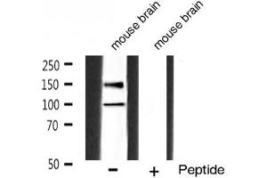 Western blot analysis of IGF1R phosphorylation expression in mouse brain tissue lysates,The lane on the right is treated with the antigen-specific peptide. (IGF1R Antikörper  (pTyr1165, pTyr1166))