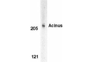 Image no. 1 for anti-Apoptotic Chromatin Condensation Inducer 1 (ACIN1) (C-Term) antibody (ABIN203607) (ACIN1 Antikörper  (C-Term))