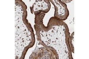 Immunohistochemical staining of human placenta with BNIP2 polyclonal antibody  shows strong cytoplasmic positivity in trophoblastic cells. (BNIP2 Antikörper)