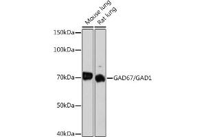 Western blot analysis of extracts of various cell lines, using G/G Rabbit mAb (ABIN7267410) at 1:1000 dilution. (GAD Antikörper)