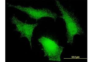 Immunofluorescence of monoclonal antibody to NEDD9 on HeLa cell. (NEDD9 Antikörper  (AA 101-200))