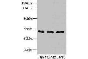 Western blot All lanes: EXOSC8 antibody at 4 μg/mL Lane 1: Mouse small intestine tissue Lane 2: Hela whole cell lysate Lane 3: K562 whole cell lysate Secondary Goat polyclonal to rabbit IgG at 1/10000 dilution Predicted band size: 31 kDa Observed band size: 31 kDa (EXOSC8 Antikörper  (AA 2-276))