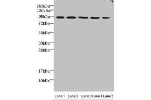 Western blot All lanes: THOC1 antibody at 3 μg/mL Lane 1: Jurkats whole cell lysate Lane 2: 293T whole cell lysate Lane 3: HepG2 whole cell lysate Lane 4: A549 whole cell lysate Lane 5: Mouse kidney tissue Secondary Goat polyclonal to rabbit IgG at 1/10000 dilution Predicted band size: 76, 44 kDa Observed band size: 76 kDa (THOC1 Antikörper  (AA 428-657))