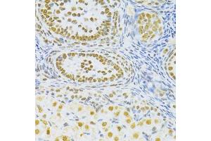 Immunohistochemistry of paraffin-embedded rat ovary using SNRNP70 antibody. (SNRNP70 Antikörper  (AA 150-250))