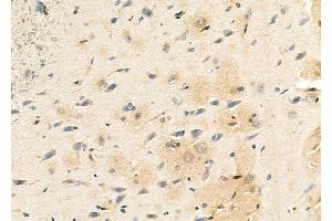 ABIN6261709 and ABIN6273117 at 1/100 staining Rat brain tissue by IHC-P. (FECH Antikörper  (C-Term))