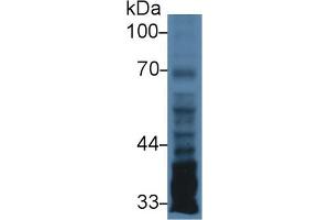 Western Blot; Sample: Human U87MG cell lysate; Primary Ab: 3µg/ml Rabbit Anti-Human PTX3 Antibody Second Ab: 0. (PTX3 Antikörper  (AA 183-381))