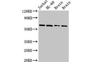 Western Blot Positive WB detected in: Jurkat whole cell lysate, HL60 whole cell lysate, Rat brain tissue, Mouse brain tissue All lanes: ARX antibody at 2. (Arx Antikörper  (AA 381-460))